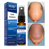 Hair Spray Thick Scalp Massage Moisturizing Care - SANDO 