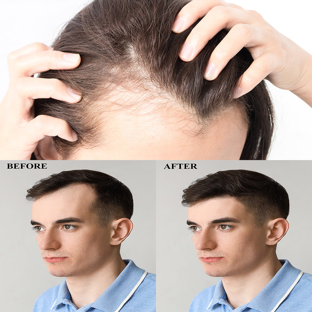 Hair Spray Thick Scalp Massage Moisturizing Care - SANDO 